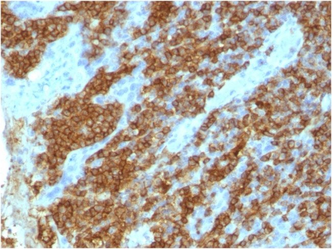 5788-MSM8-P0-CD45RA-IHCP-1-20230720_133512.jpg