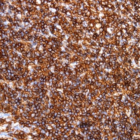 603-131-CD45-IHCP-1-20220105_082936