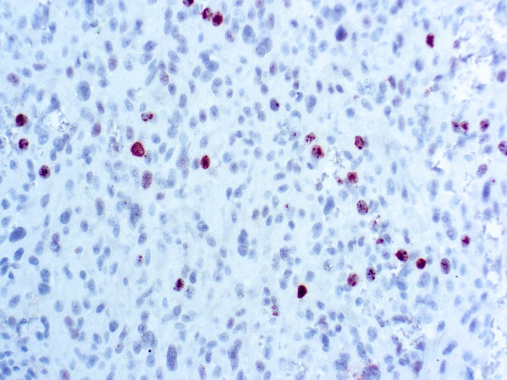 ACTH57