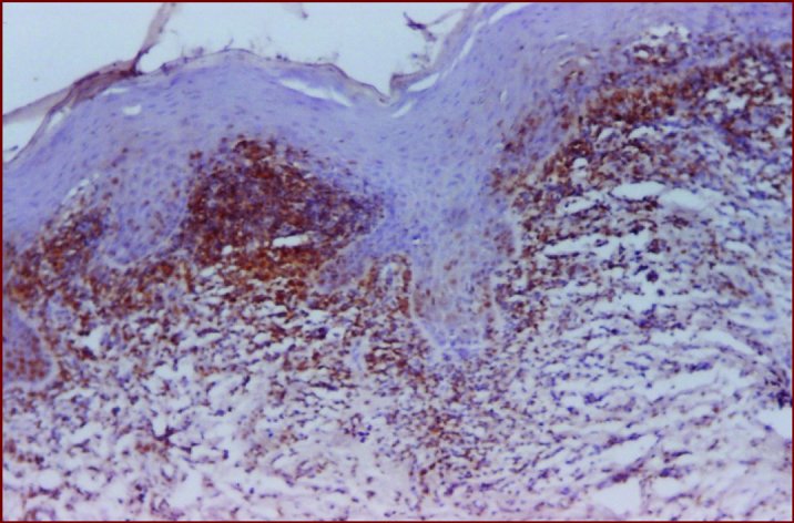 CD45RO (T-Cell Marker)