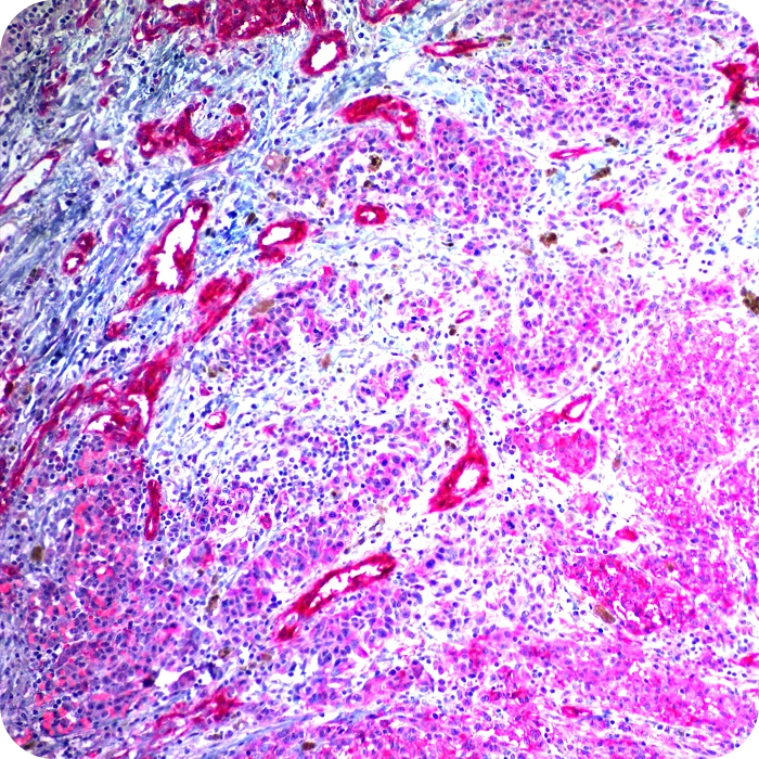 RA0416-C.5