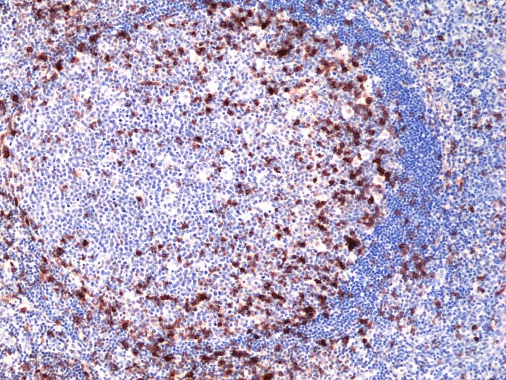 RM417_Fig-1_IHC-