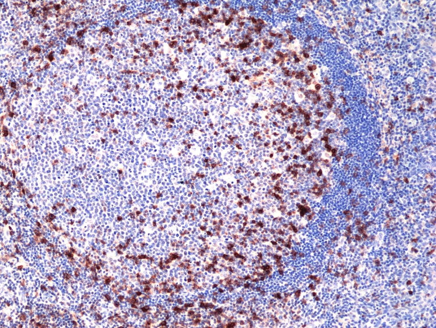 RM417_Fig-1_IHC-