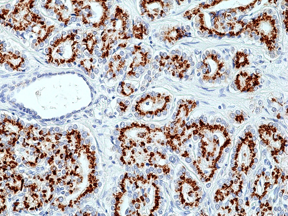 RM426_Fig1_IHC.rev_