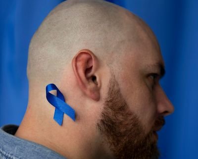 Antibodies Tissue For Head & Neck Cancer
