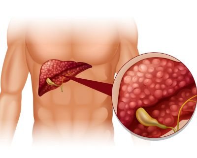 Antibody Tissue For Gall Cancer