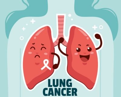 Antibody Tissue For Lung Cancer