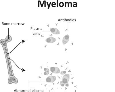 Antibody Tissue For Multiple Myeloma Cancer
