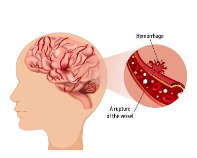 Antibody Tissue For Neuro Cancer