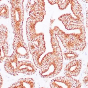 AMACR Rabbit Monoclonal Primary Antibody