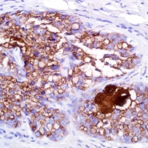 Adipophilin (Polyclonal)