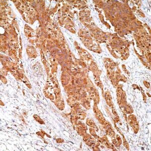 Calcitonin (Polyclonal)