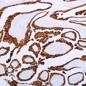Cytokeratin 19 (EP72)