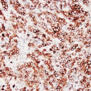 Podoplanin Mouse Monoclonal Primary Antibody