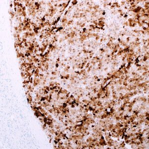 Heat Shock Protein 70 (EP377)