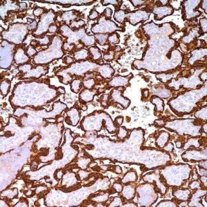 Human Placental Lactogen (hPL)