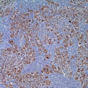 MART-1 (Melan A) (A103)