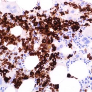 Myeloperoxidase (EP151)