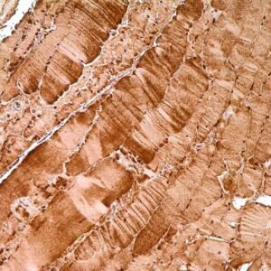 Myoglobin  Polyclonal