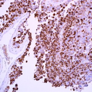 Neurofilament (EP79)