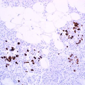 Somatostatin (EP130)