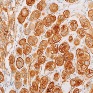 Somatostatin Receptor 2 (SSTR2) (EP149)