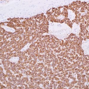 Synaptophysin (EP158)