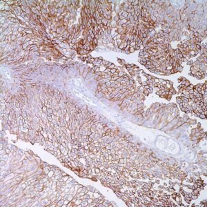 Thrombomodulin (1009)