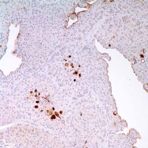 Uroplakin-III (AU-1)