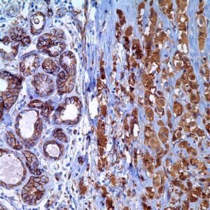 p120 Catenin (MRQ-5)