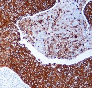 immunohistochemistry